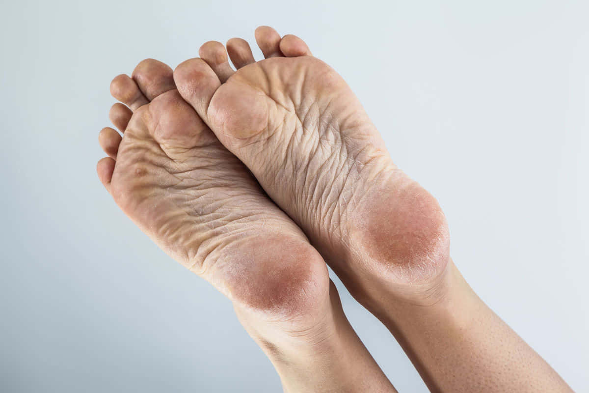 Wrinkly Foot Sole Wallpaper