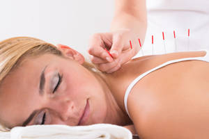 Acupuncturist Back Needles Treatment Wallpaper