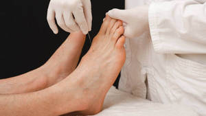 Acupuncturist Feet Needle Treatment Wallpaper