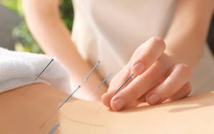 Acupuncturist Inserting Needle Into Patient's Skin Wallpaper