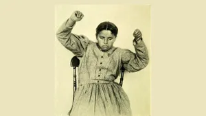 Patient In A Catatonic Position Wallpaper