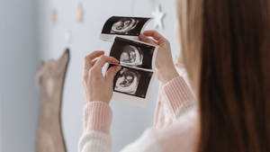 Pregnancy Sonogram Pictures Wallpaper