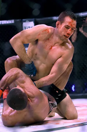 Rory Macdonald With A Bloody Nose Wallpaper