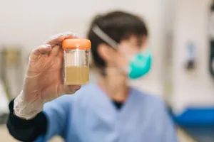 Urine Laboratory Test Sample In Cup Wallpaper